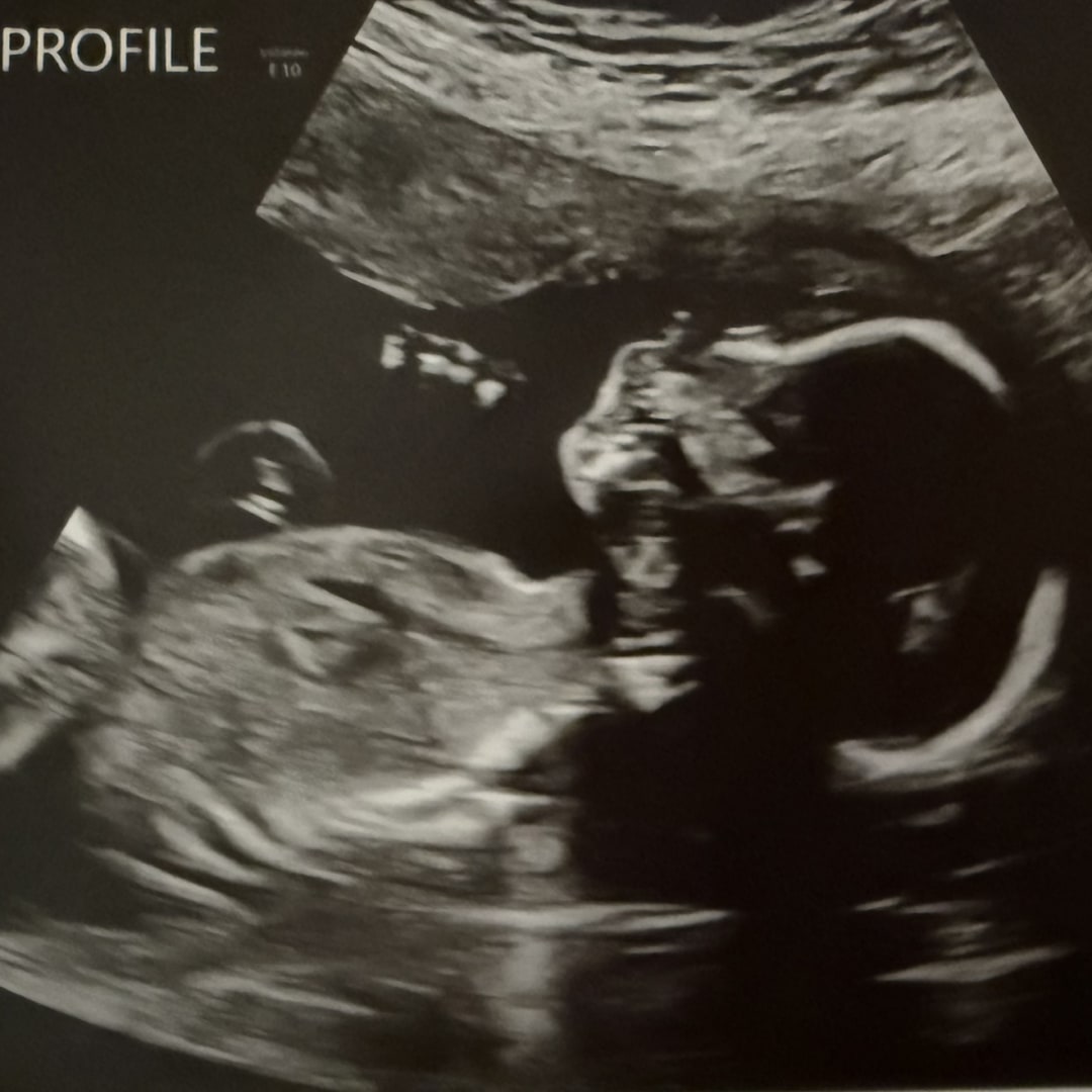 Photo shared by Mary for their Babylist baby registry.