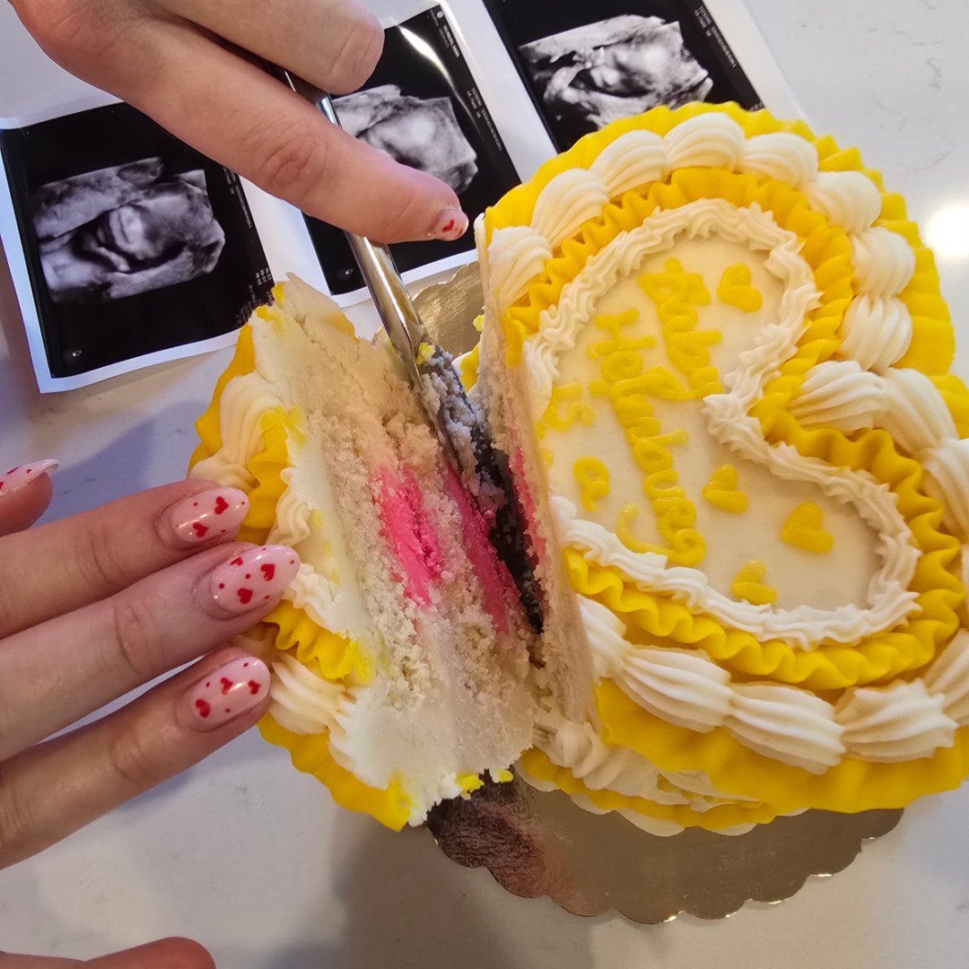 Photo shared by Anina for their Babylist baby registry.