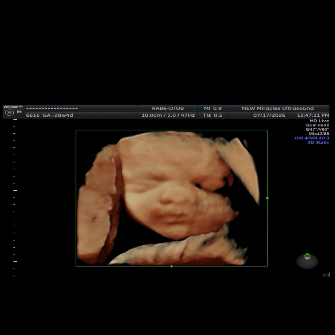 Photo shared by Savannah and Josh for their Babylist baby registry.