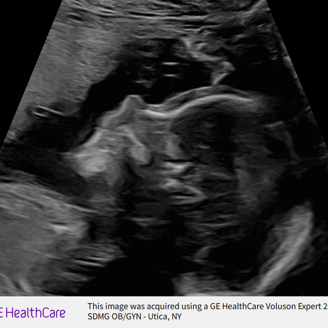 Photo shared by Emily for their Babylist baby registry.