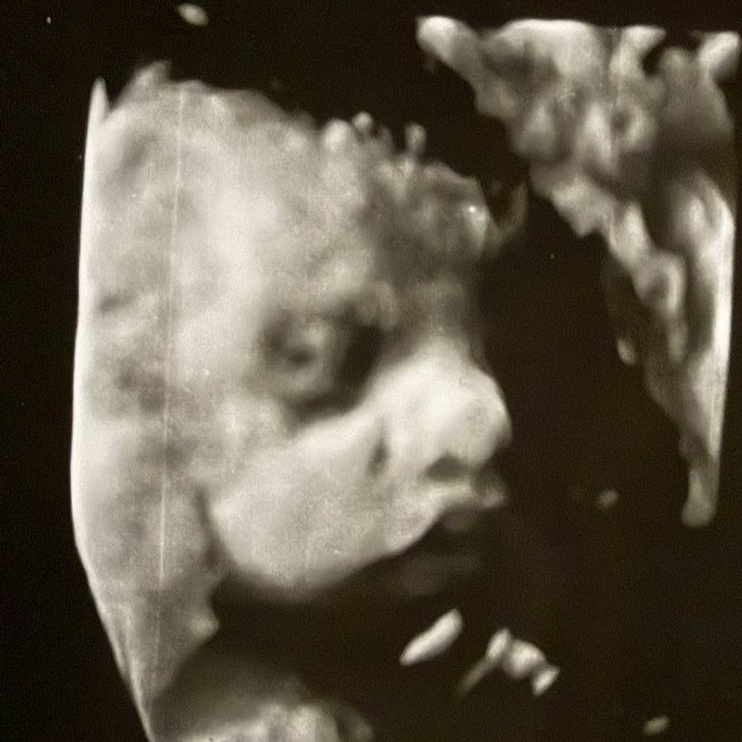 Photo shared by Brittney for their Babylist baby registry.