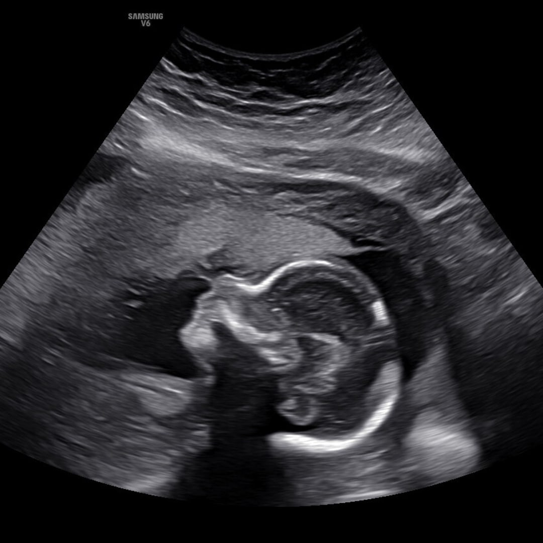 Photo shared by Mackenzie for their Babylist baby registry.