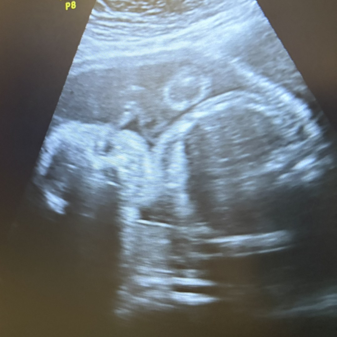Photo shared by Gianna for their Babylist baby registry.