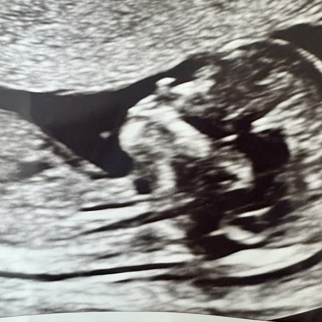 Photo shared by Hannah for their Babylist baby registry.