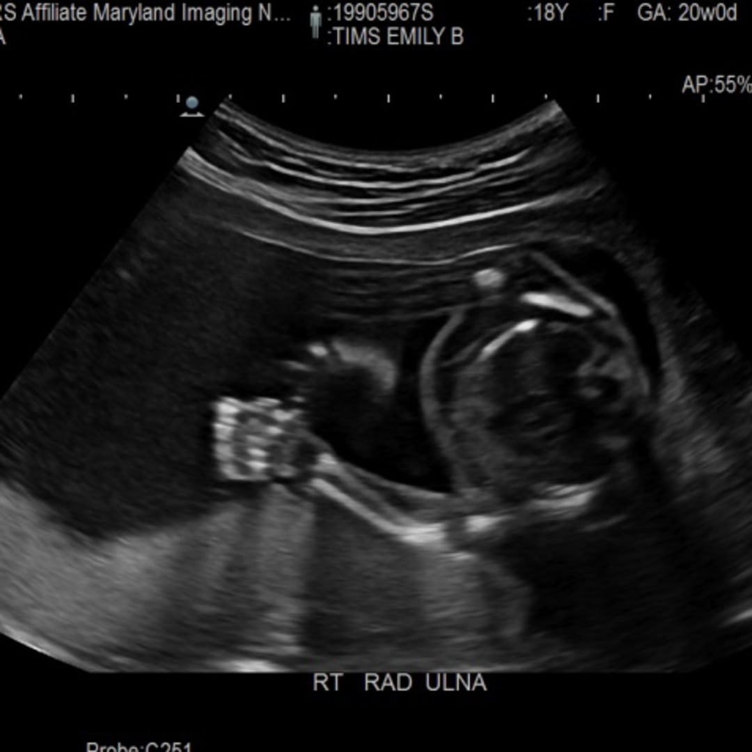 Photo shared by Emily for their Babylist baby registry.