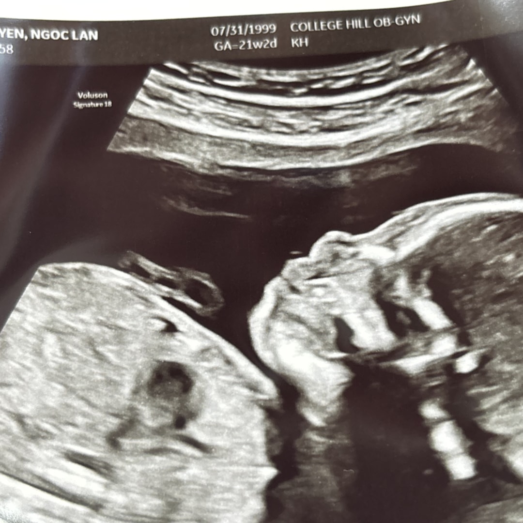 Photo shared by Davina for their Babylist baby registry.
