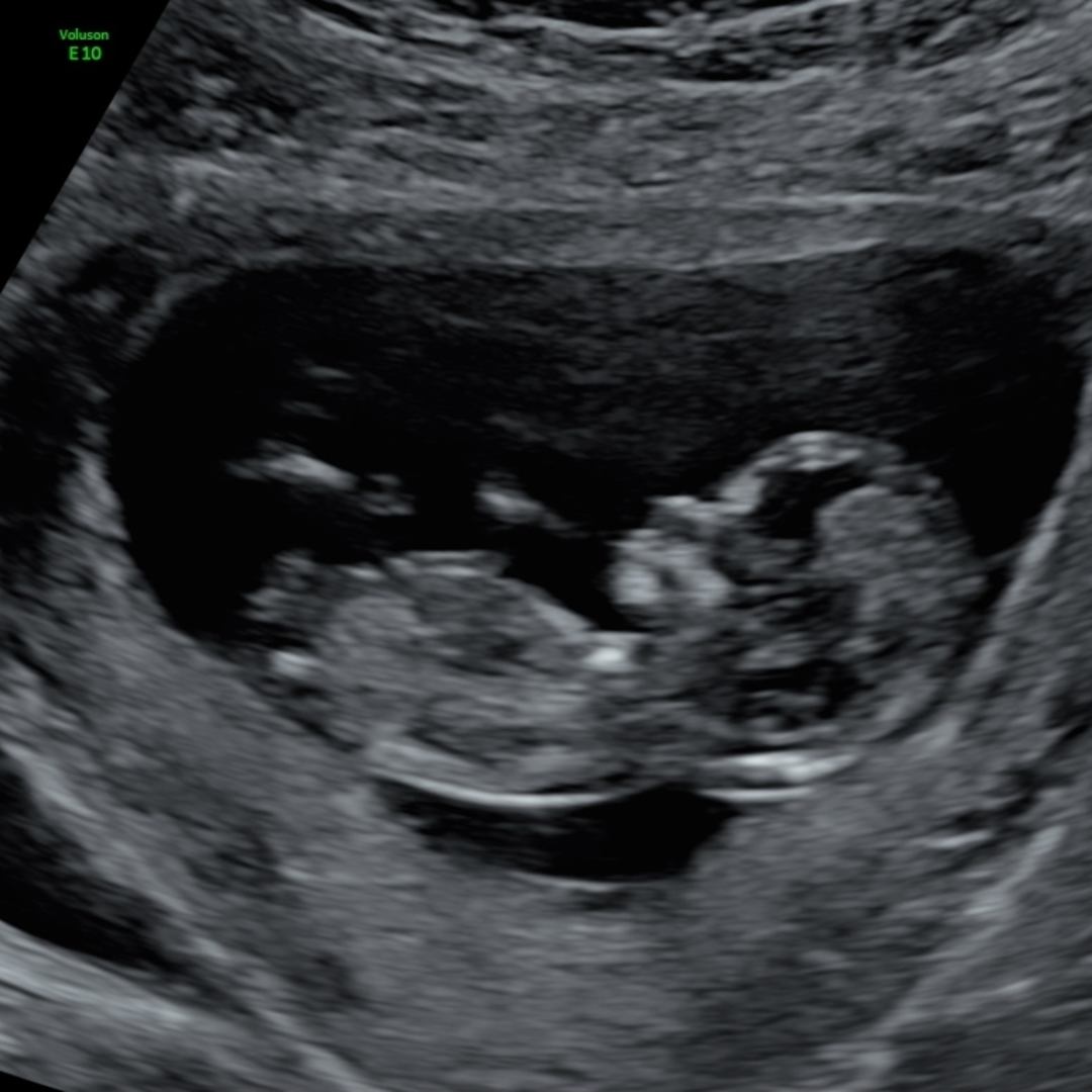 Photo shared by Alyssa for their Babylist baby registry.