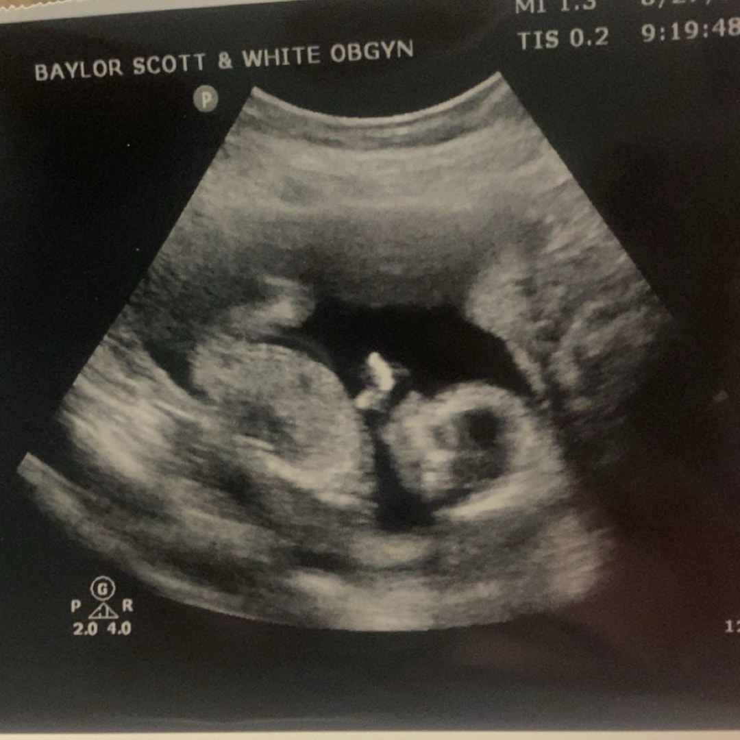 Photo shared by Baylie for their Babylist baby registry.