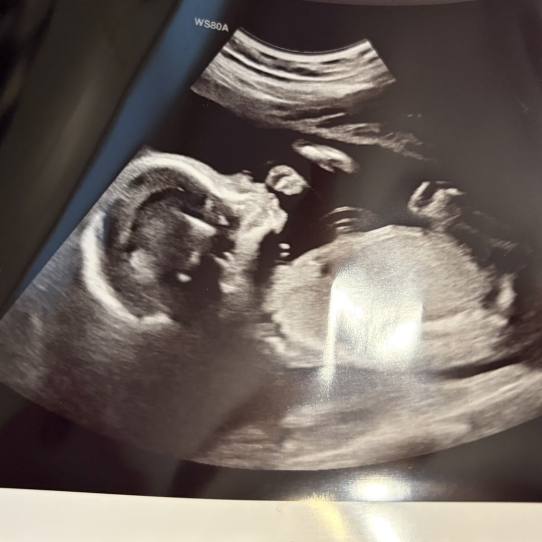 Photo shared by Jeana for their Babylist baby registry.