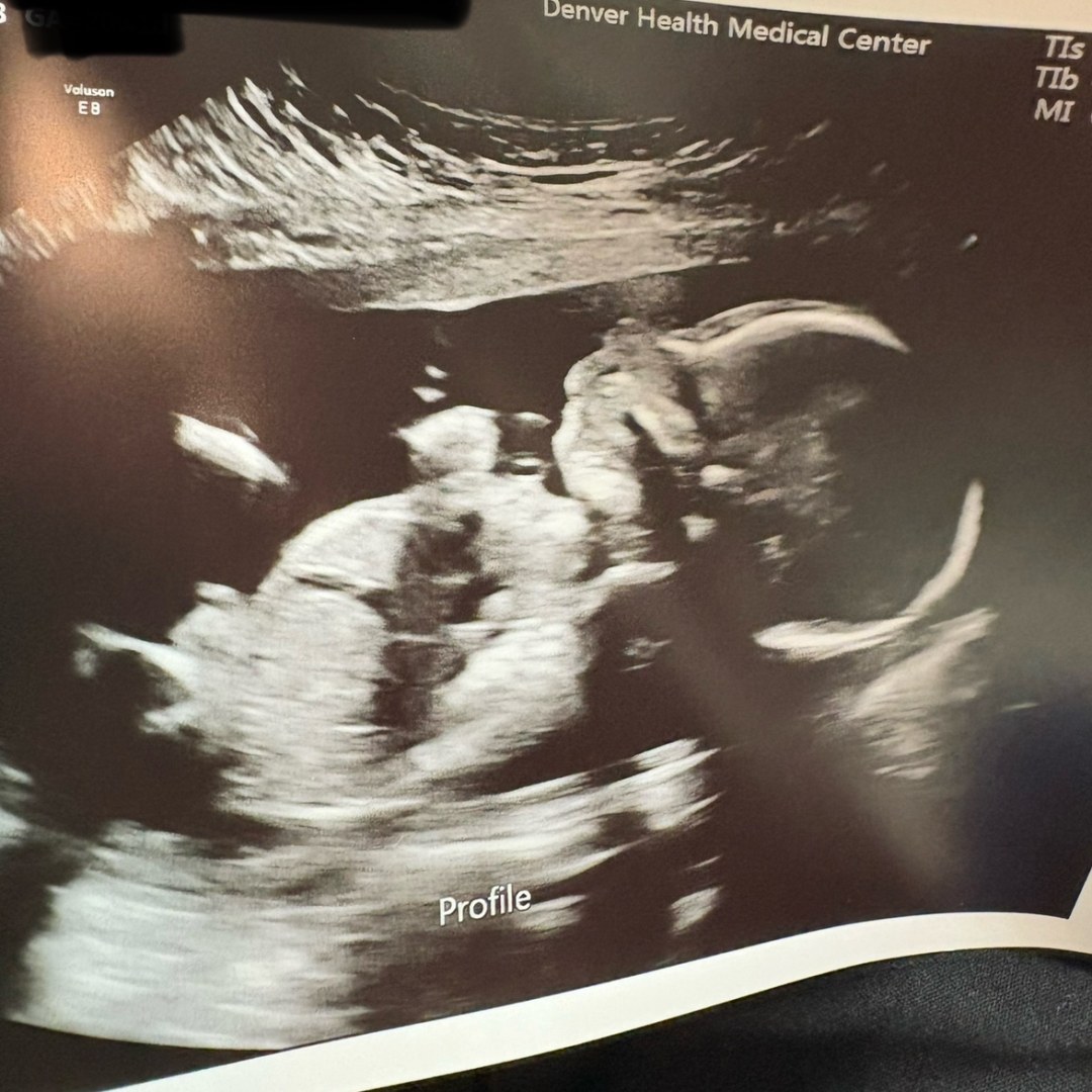 Photo shared by BRE for their Babylist baby registry.