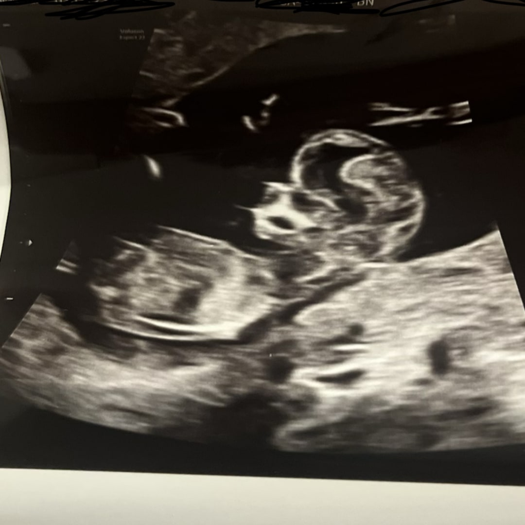 Photo shared by Amaya for their Babylist baby registry.