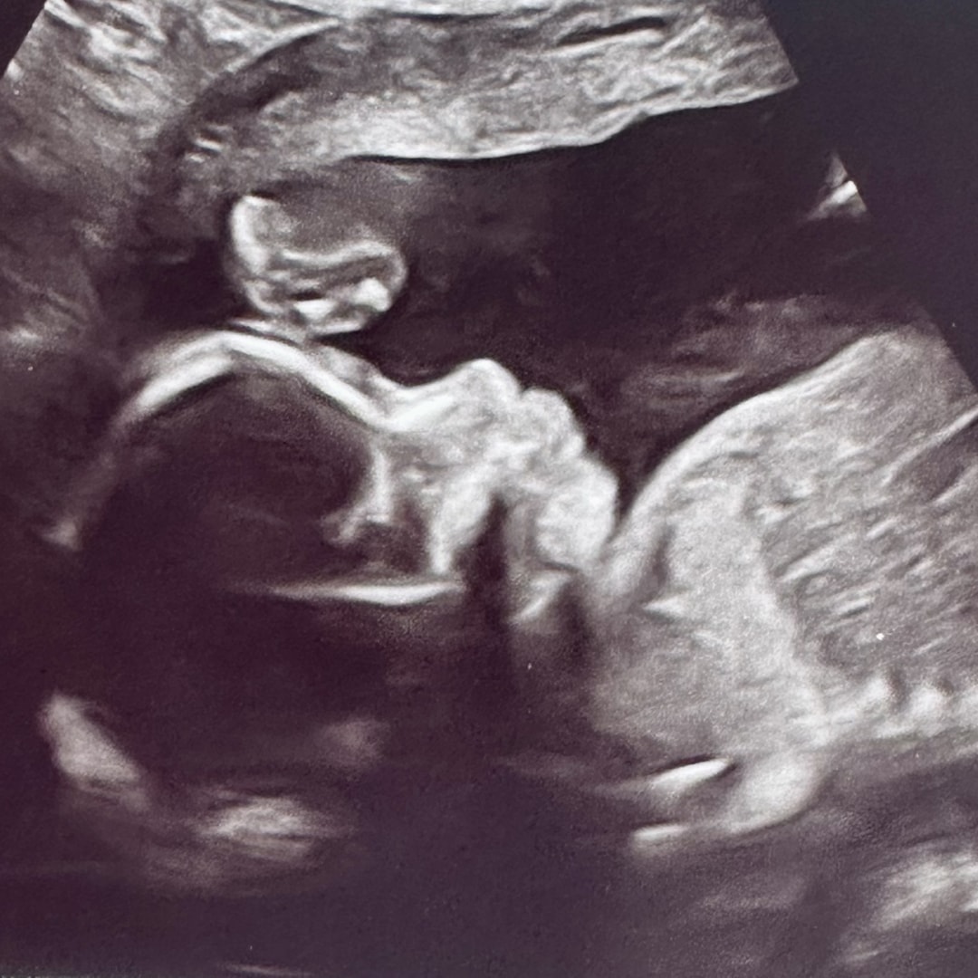 Photo shared by Christa for their Babylist baby registry.