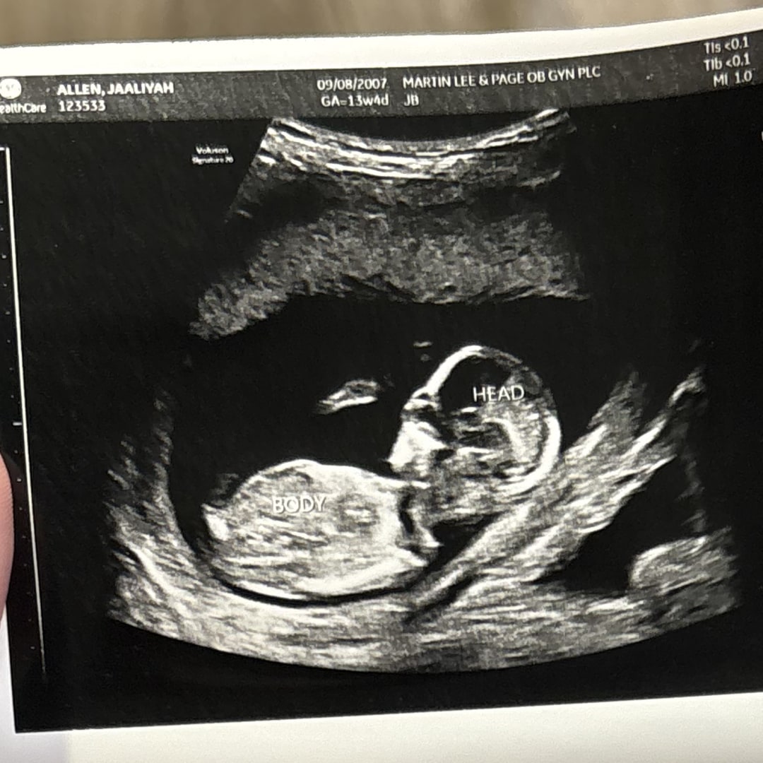 Photo shared by Jaaliyah for their Babylist baby registry.