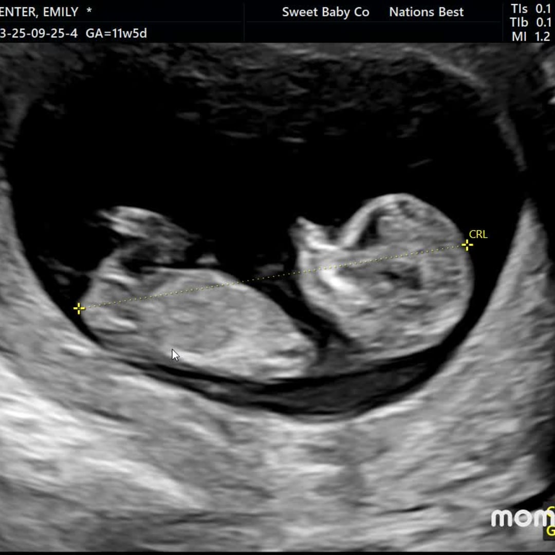 Photo shared by Emily for their Babylist baby registry.