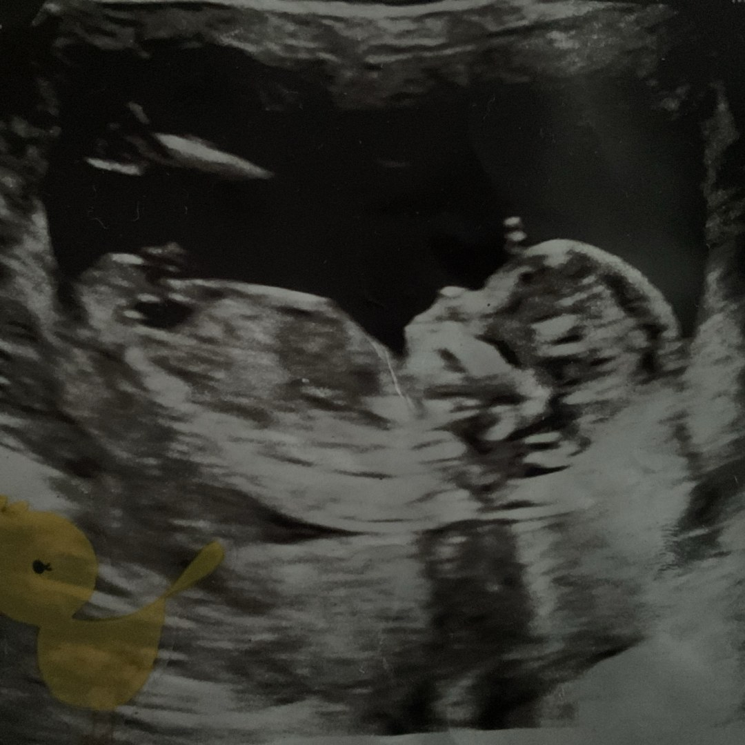 Photo shared by Cinyah for their Babylist baby registry.