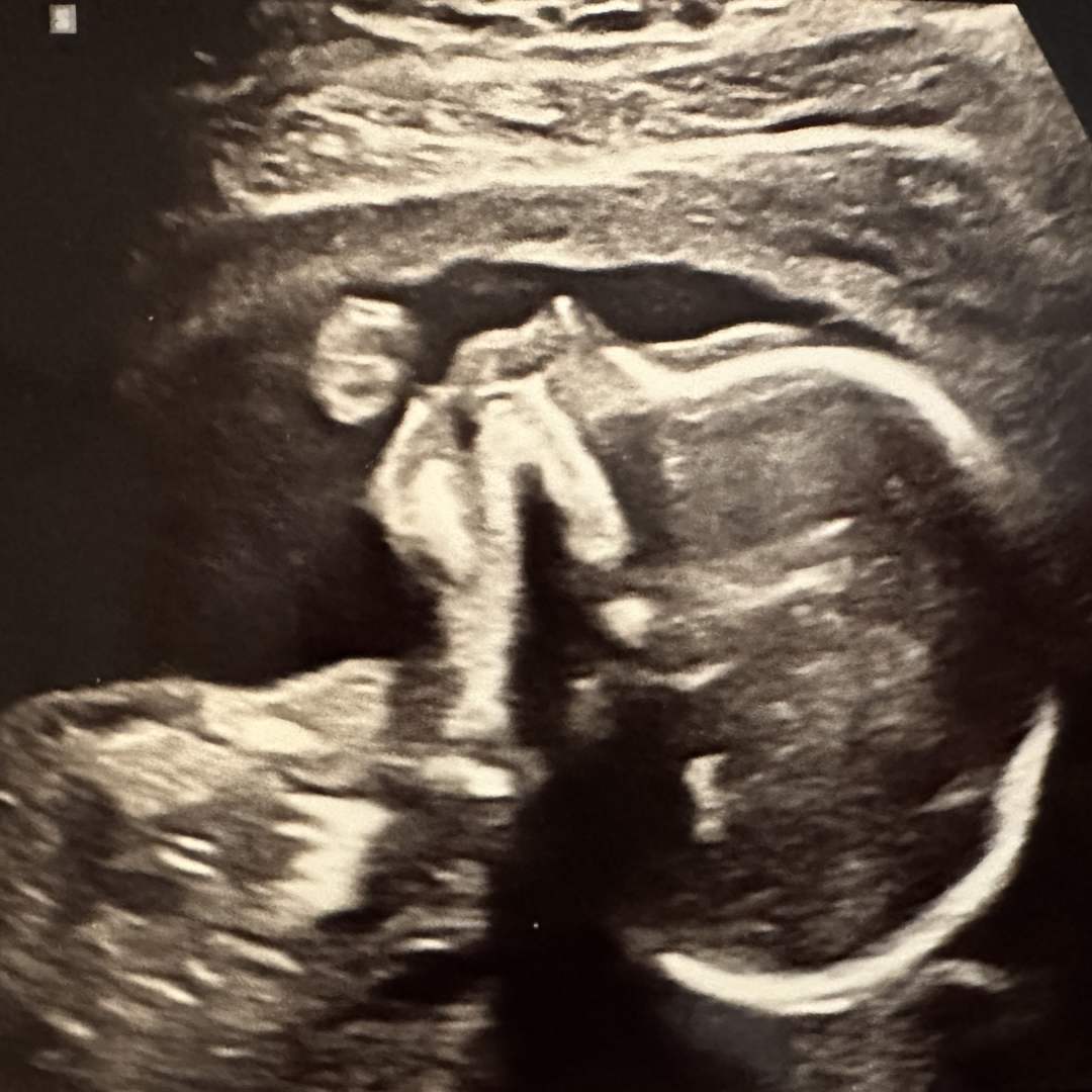 Photo shared by Ella for their Babylist baby registry.