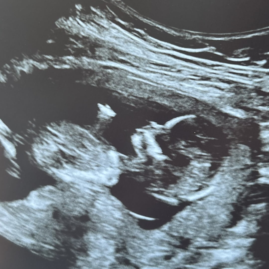 Photo shared by Kiersten for their Babylist baby registry.