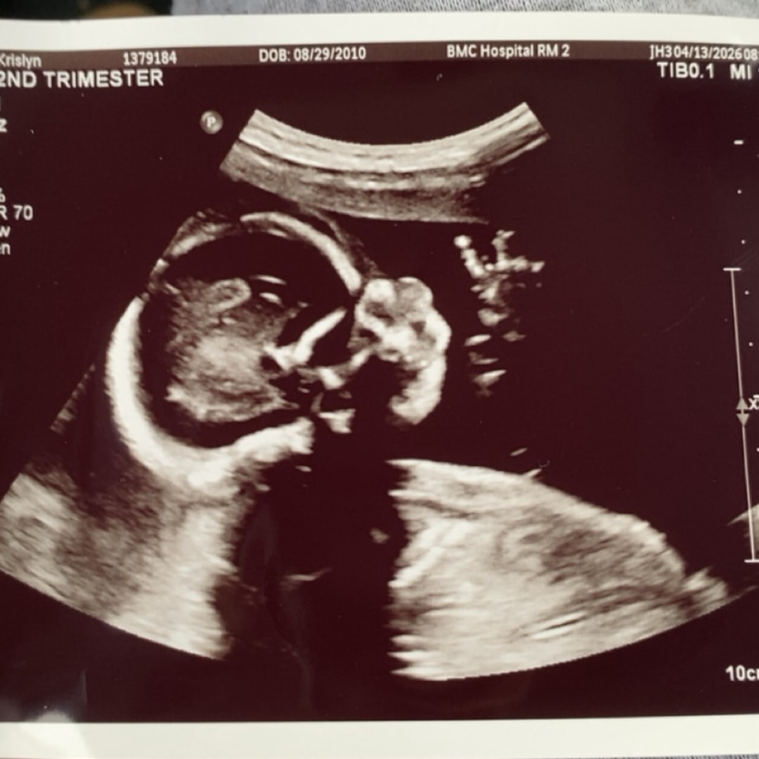 Photo shared by Krislyn for their Babylist baby registry.
