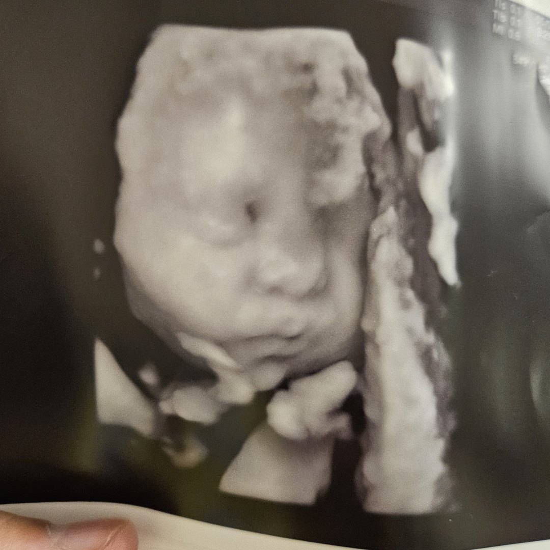 Photo shared by Gabriela for their Babylist baby registry.