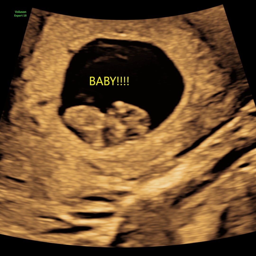 Photo shared by Chloe for their Babylist baby registry.