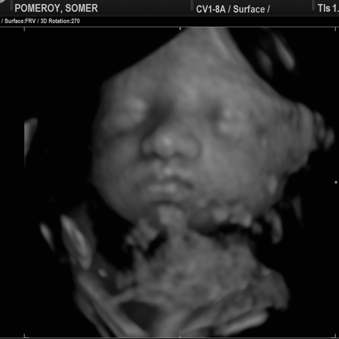 Photo shared by Somer for their Babylist baby registry.