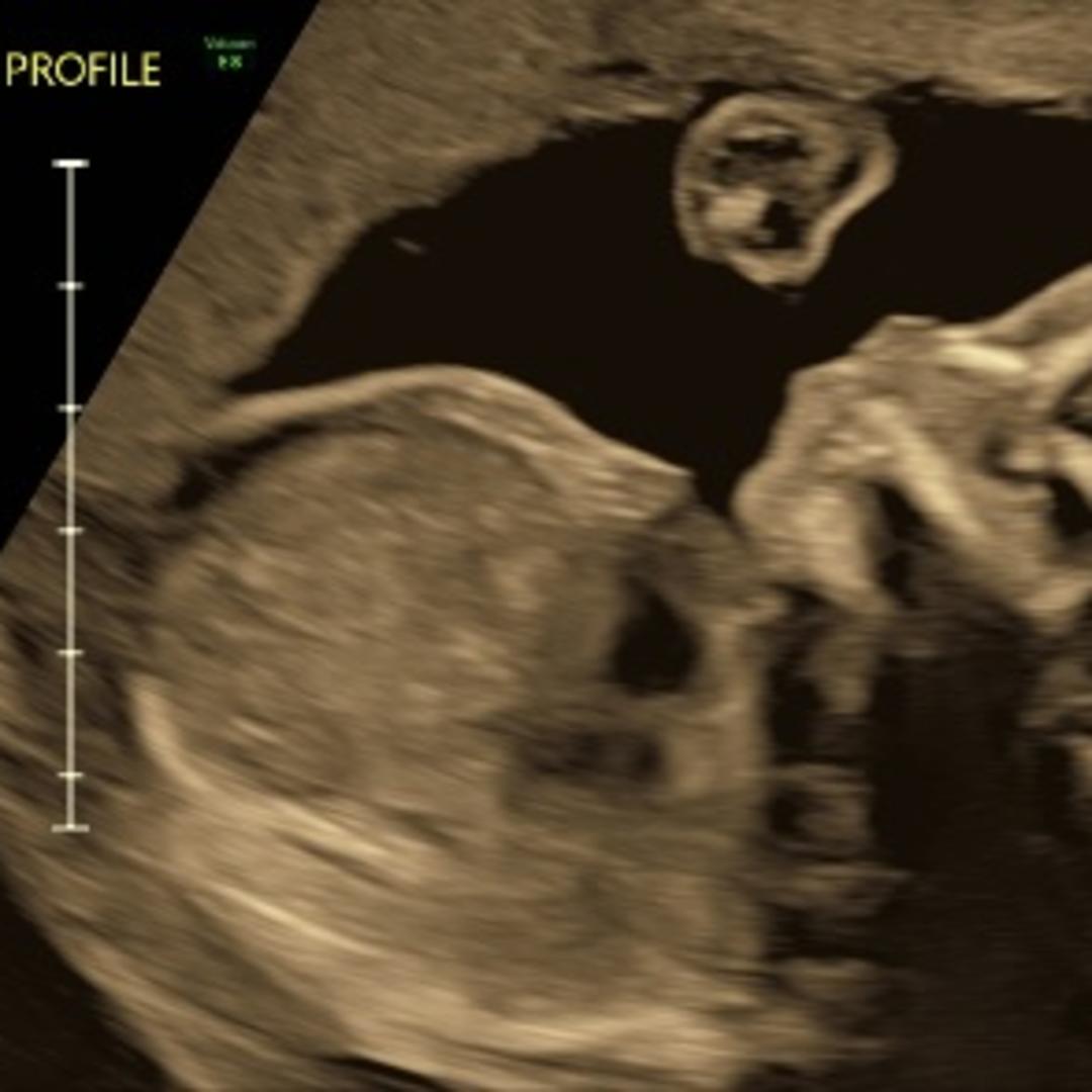 Photo shared by Kate for their Babylist baby registry.