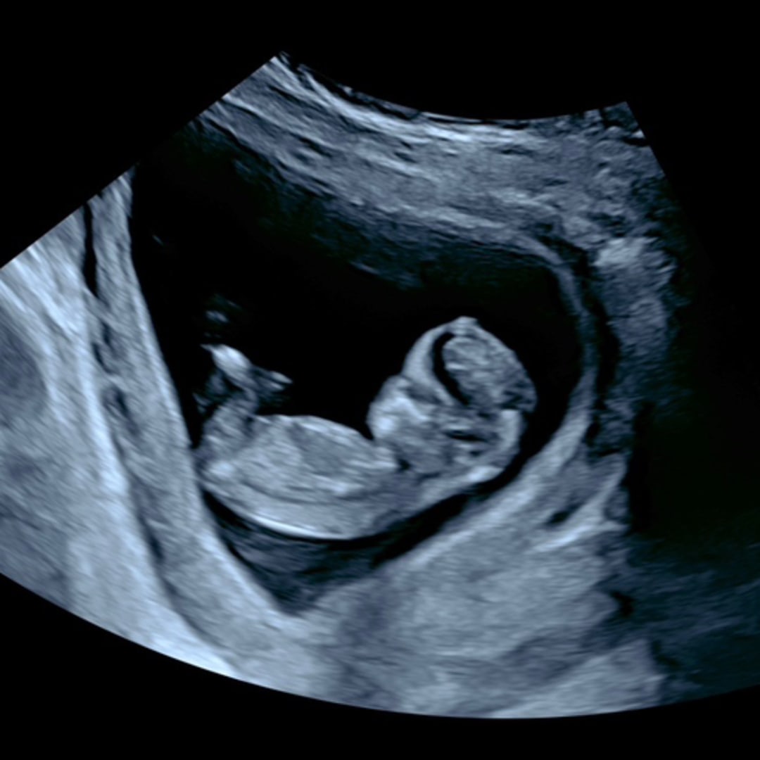 Photo shared by Yoela for their Babylist baby registry.