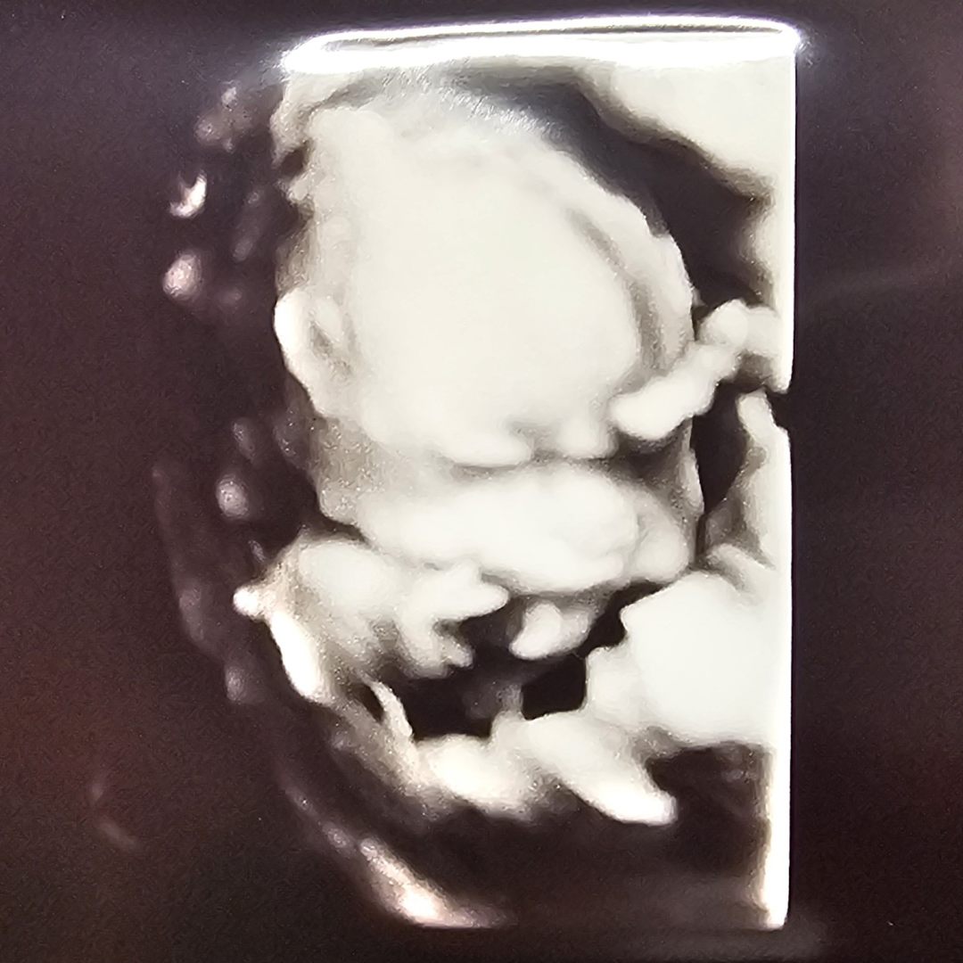 Photo shared by Brie for their Babylist baby registry.