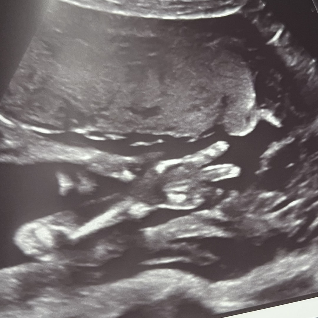 Photo shared by Cierra for their Babylist baby registry.