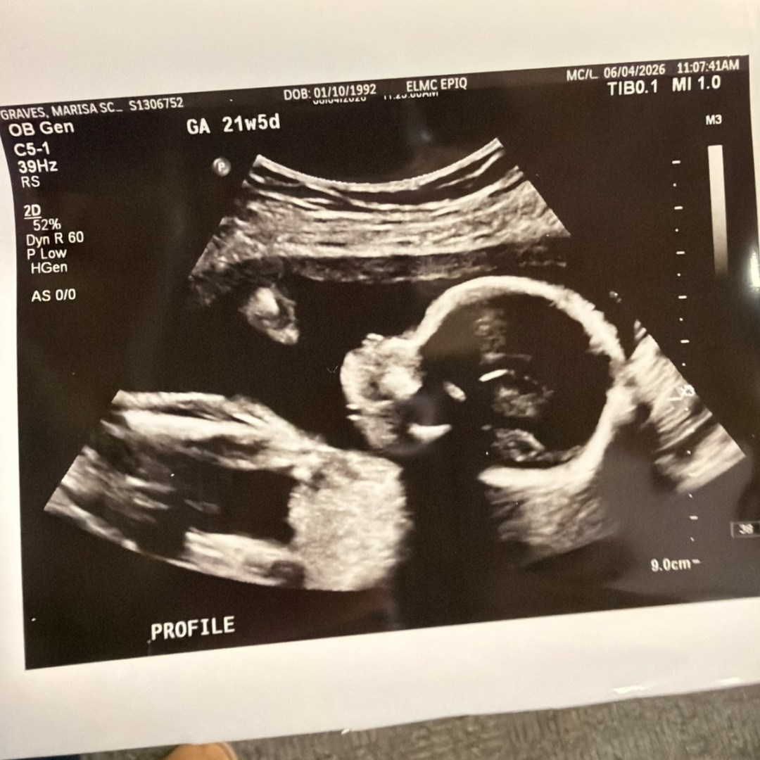Photo shared by Marisa for their Babylist baby registry.