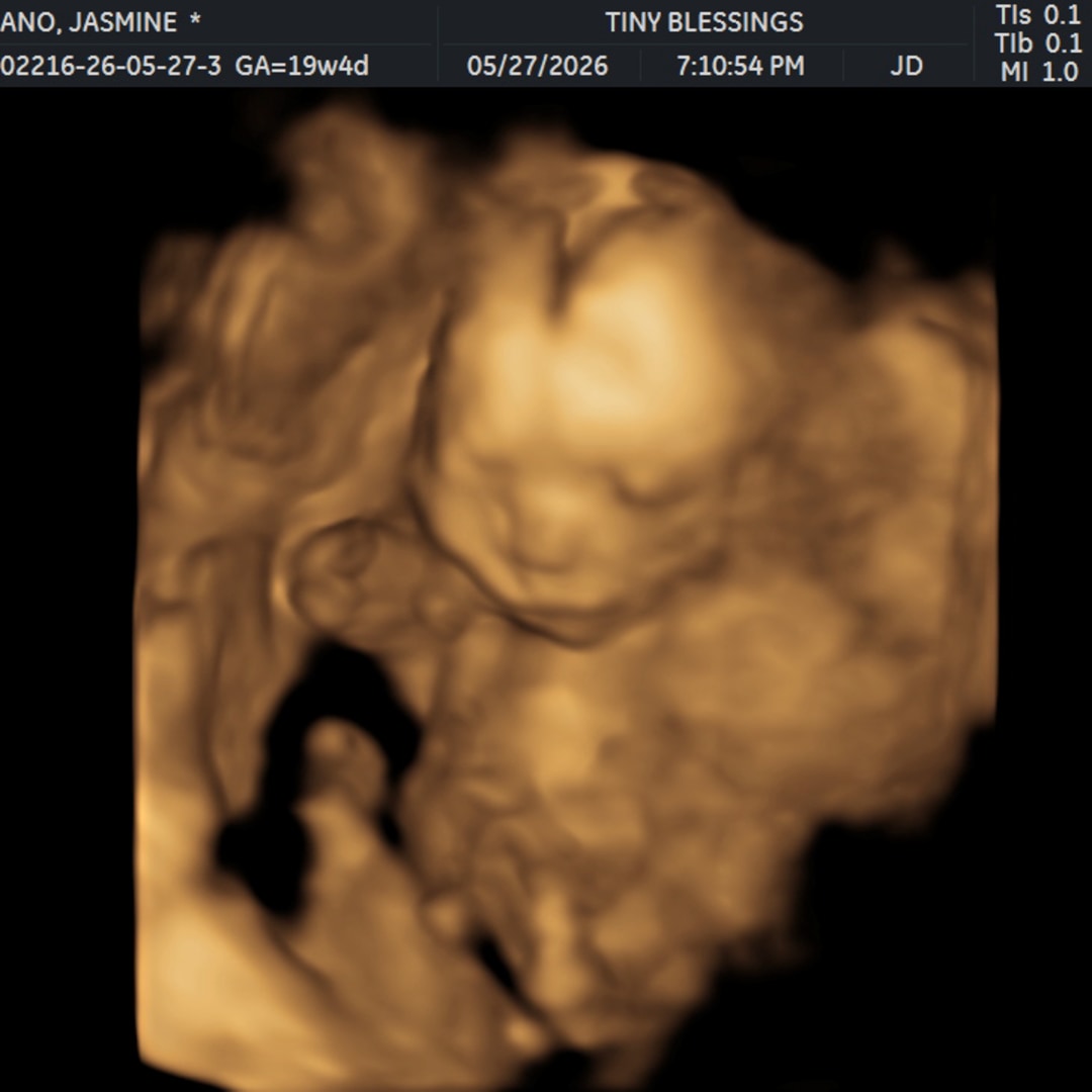 Photo shared by Jasmine for their Babylist baby registry.