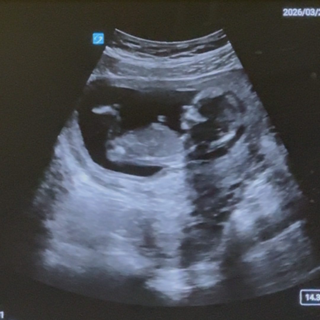 Photo shared by Rachel for their Babylist baby registry.