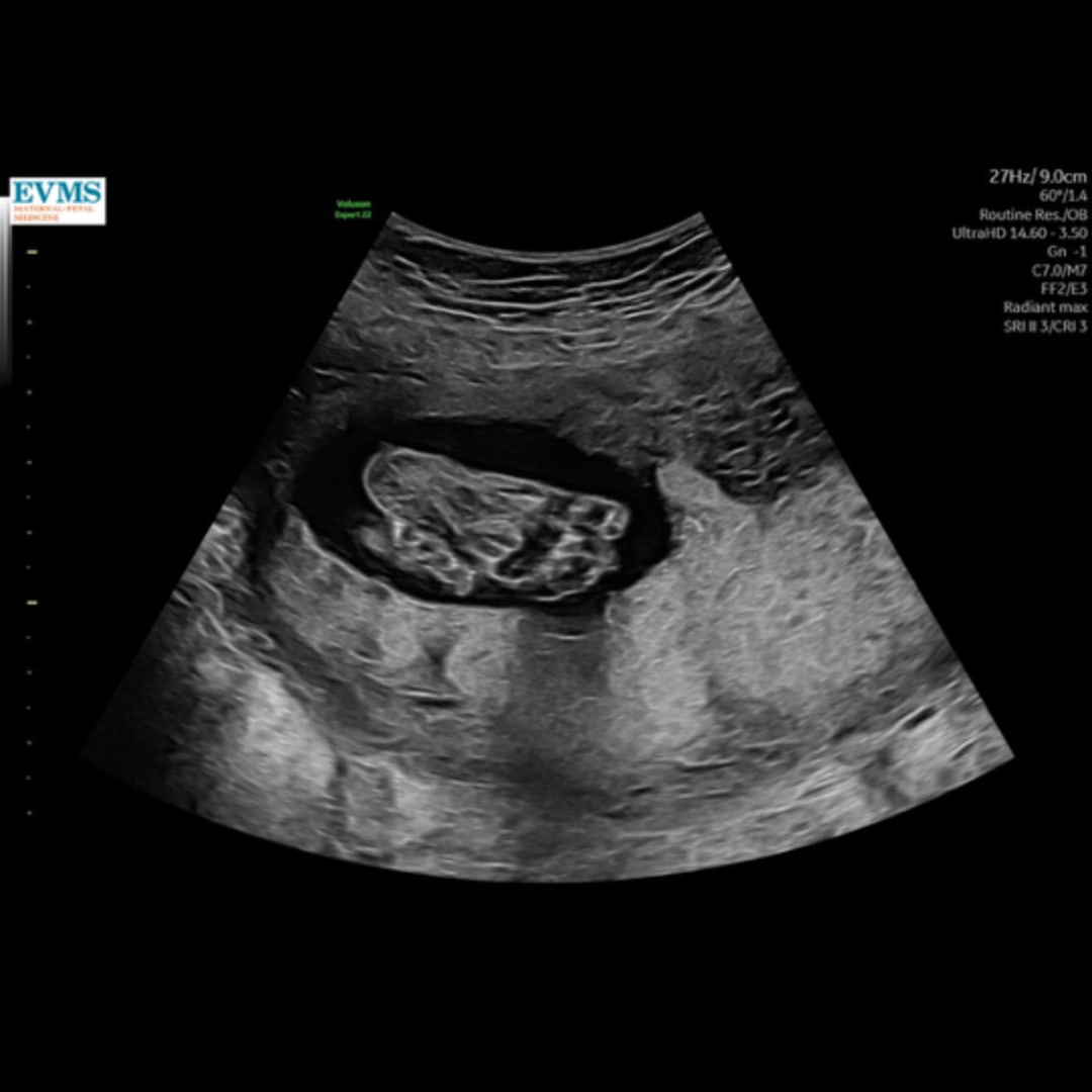 Photo shared by Camrin for their Babylist baby registry.