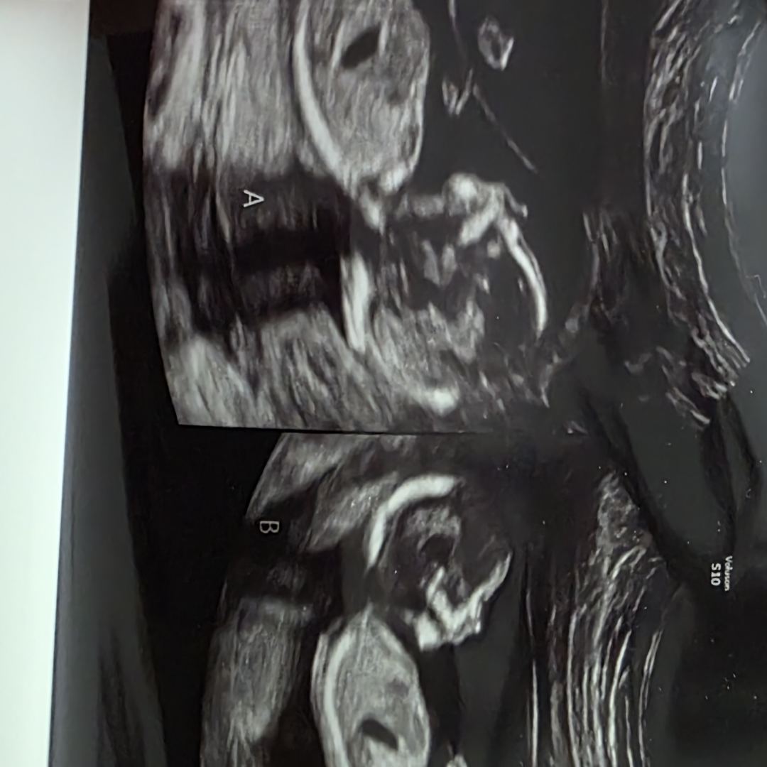 Photo shared by Justyna for their Babylist baby registry.