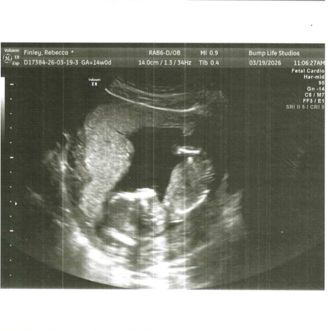 Photo shared by Rebecca for their Babylist baby registry.