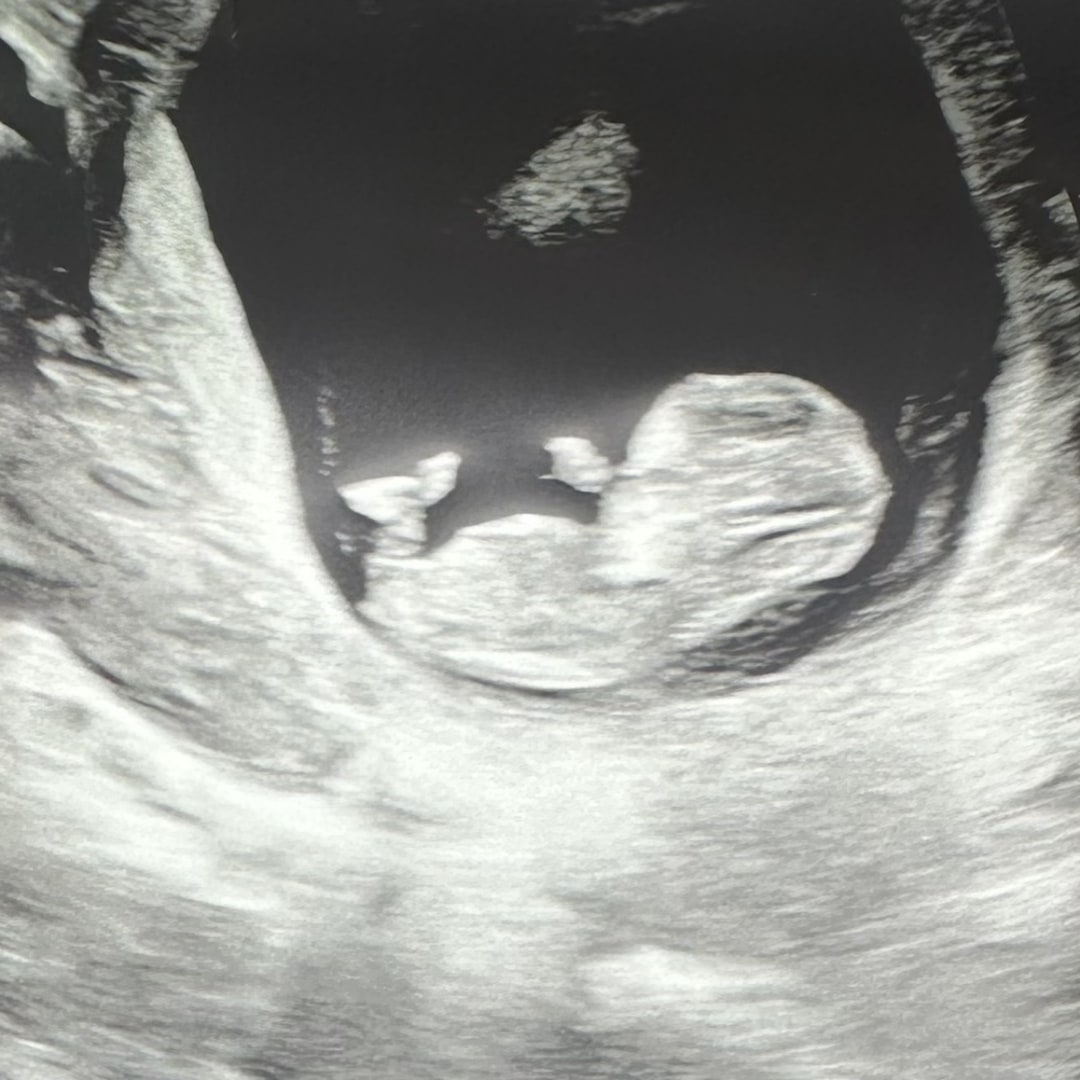 Photo shared by Giovana for their Babylist baby registry.