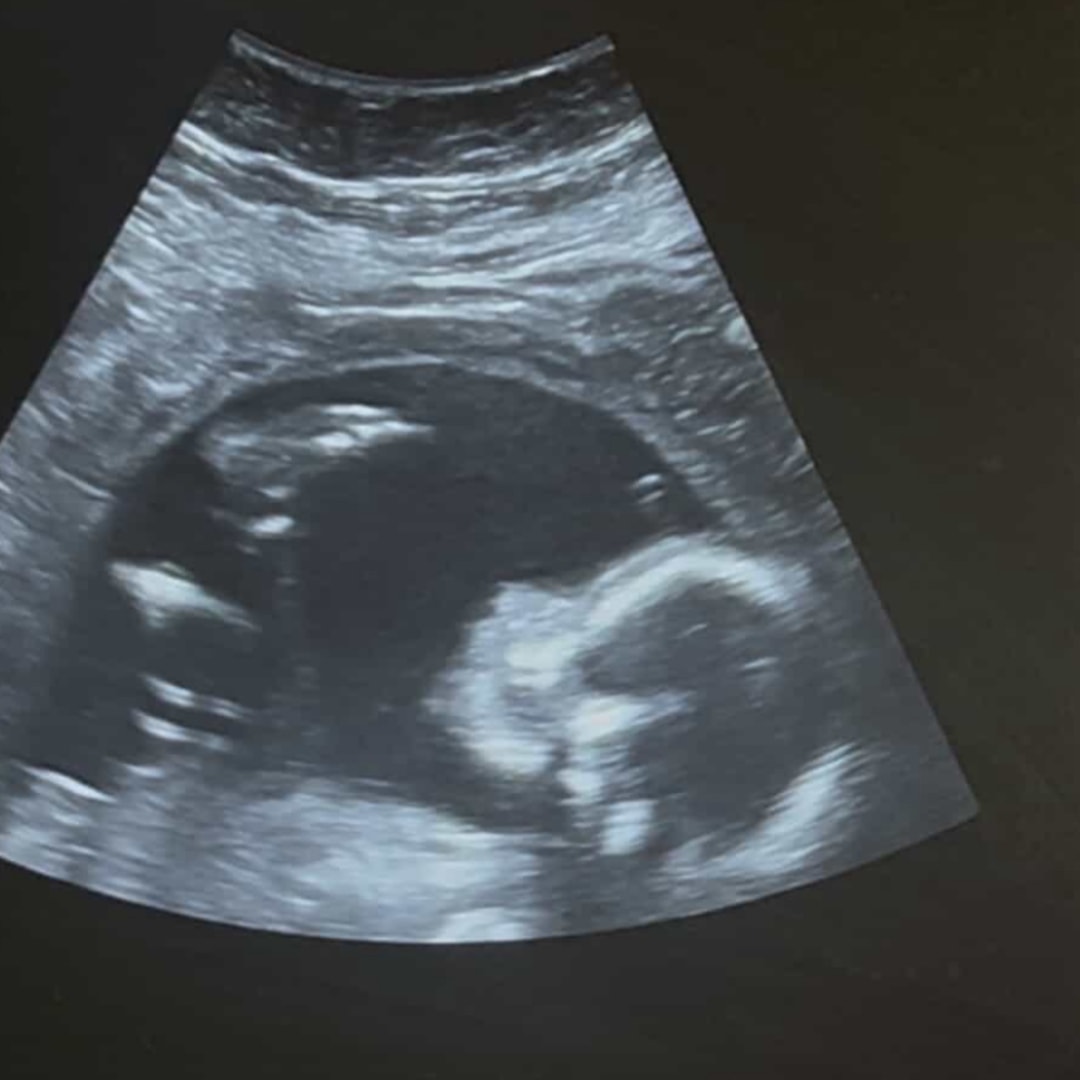 Photo shared by Johanna for their Babylist baby registry.