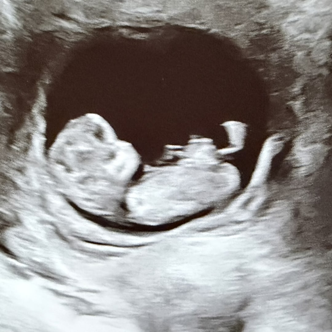 Photo shared by Natalie for their Babylist baby registry.