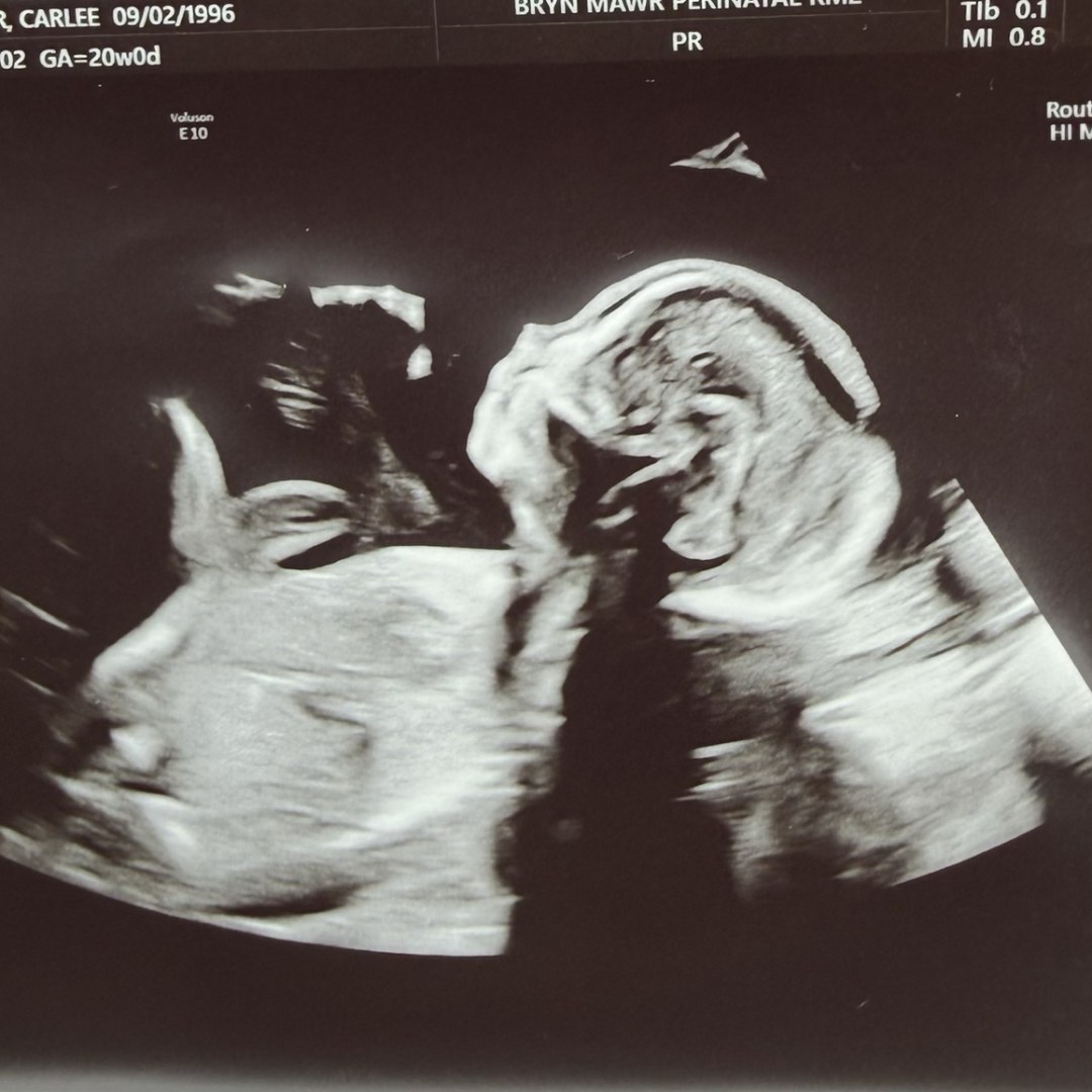 Photo shared by Carlee for their Babylist baby registry.