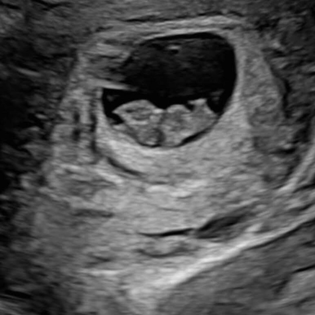 Photo shared by Autum for their Babylist baby registry.