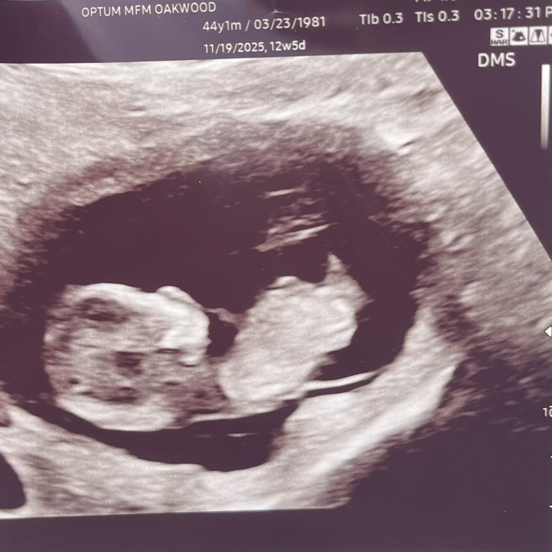 Photo shared by Heather for their Babylist baby registry.
