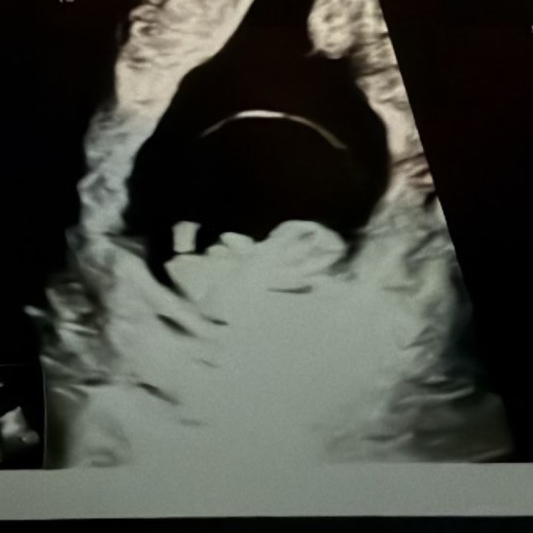 Photo shared by Elise for their Babylist baby registry.