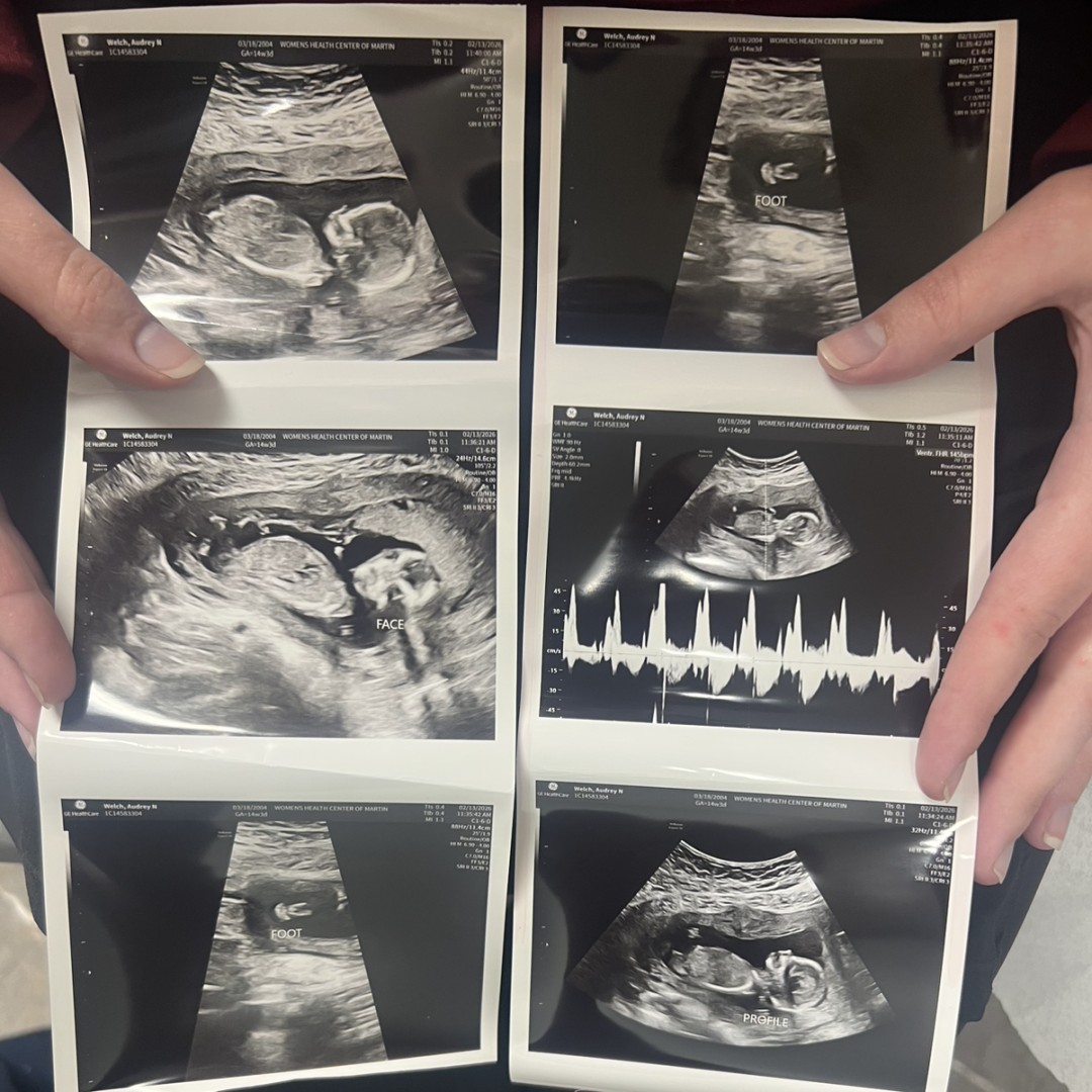 Photo shared by Audrey for their Babylist baby registry.