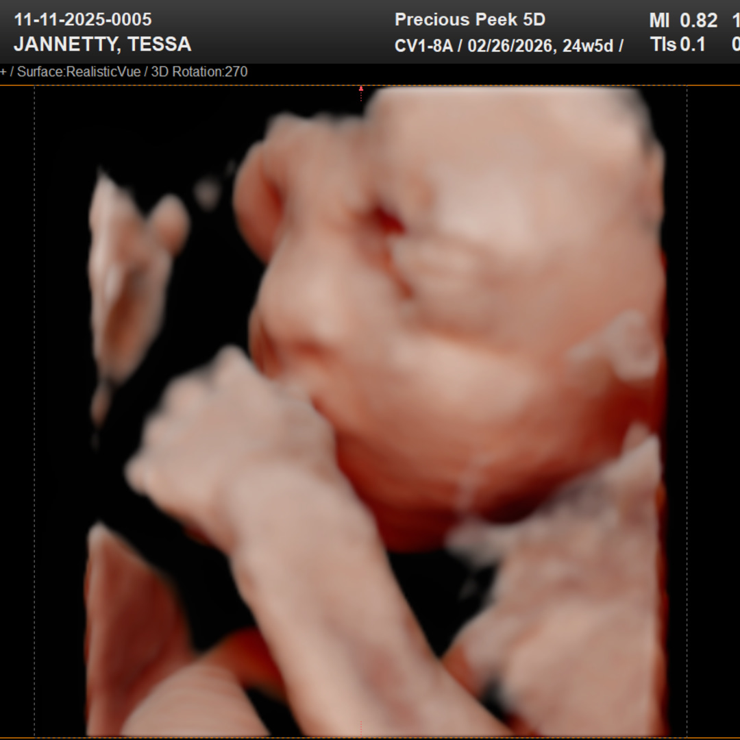 Photo shared by Tessa for their Babylist baby registry.