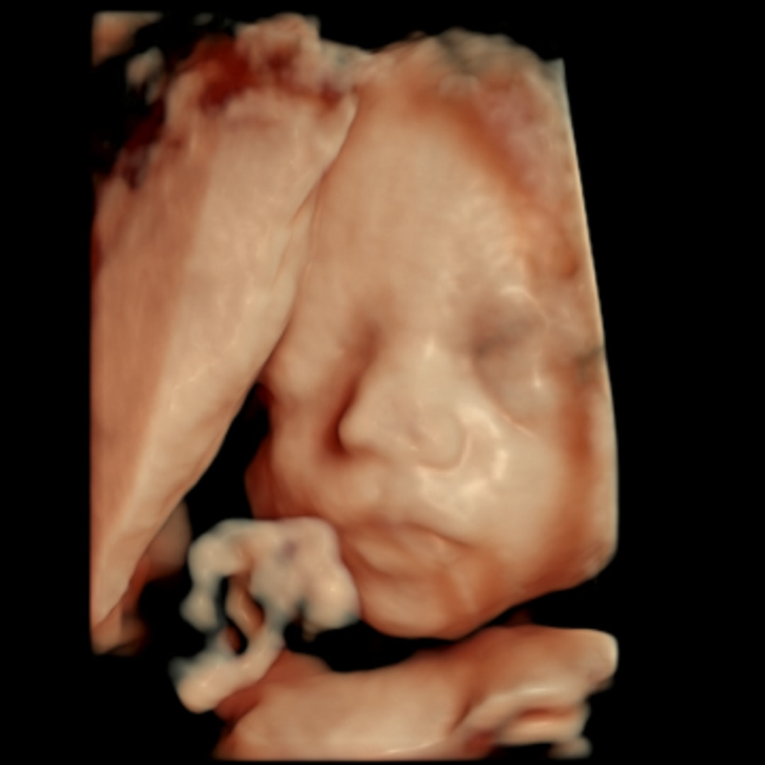 Photo shared by Hannah for their Babylist baby registry.