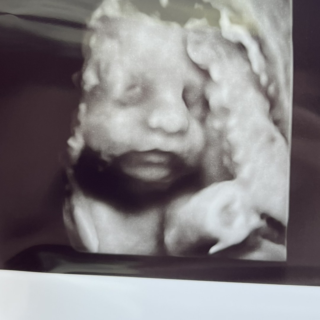 Photo shared by Elizabeth for their Babylist baby registry.
