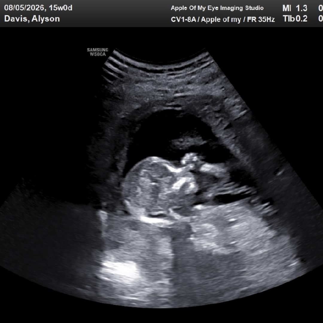 Photo shared by Aly for their Babylist baby registry.