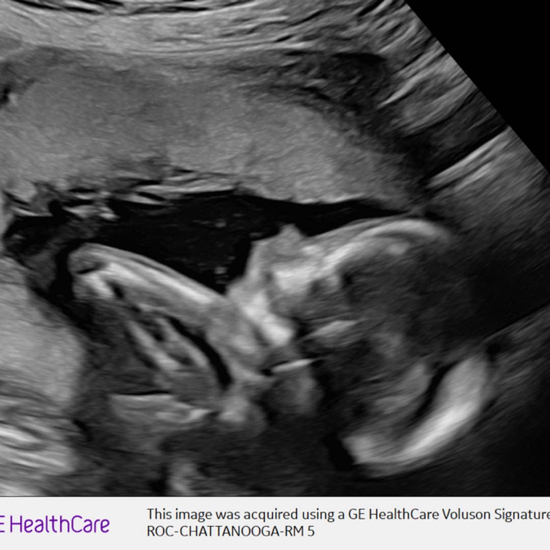 Photo shared by Emily for their Babylist baby registry.