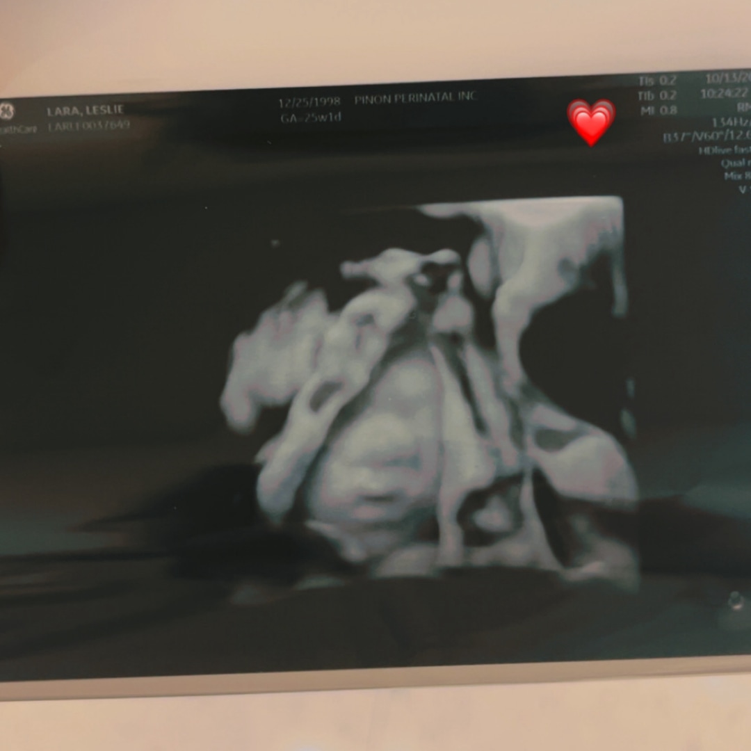 Photo shared by Leslie for their Babylist baby registry.