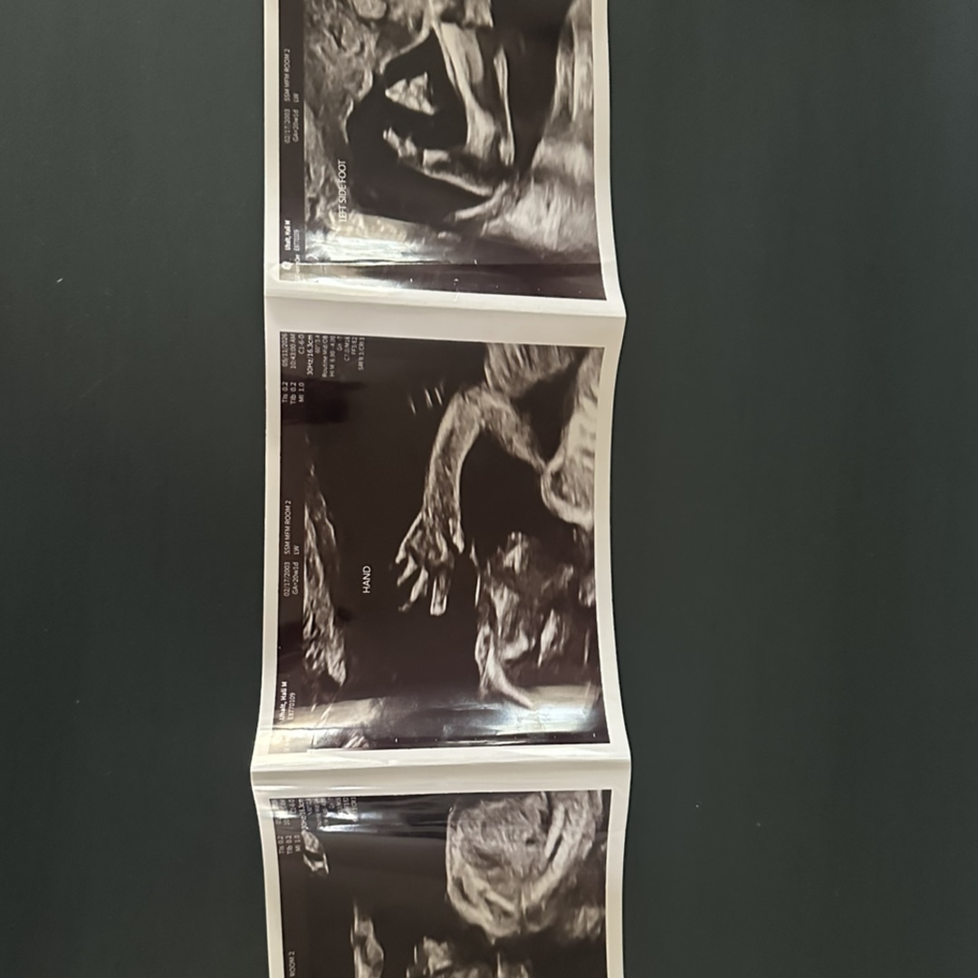 Photo shared by Hali for their Babylist baby registry.